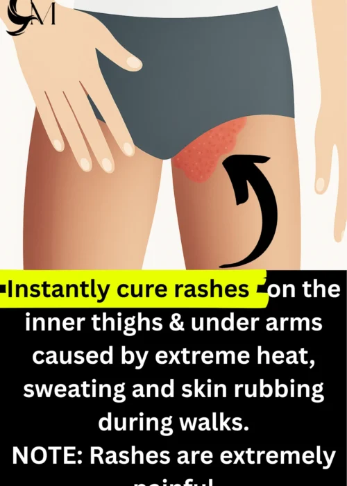 RASH CREAM