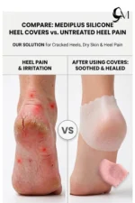 silicone heel protector