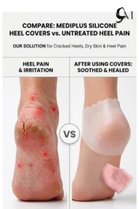 silicone heel protector